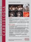Revisión de 2011 sobre el tratamiento de la cardiopatí­a isquémica